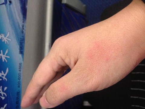 无论怎样摸手霜,玉手依然是皴了.